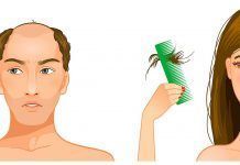 Posibles factores que intervienen en la caída del cabello Posibles factores que intervienen en la caída del cabello