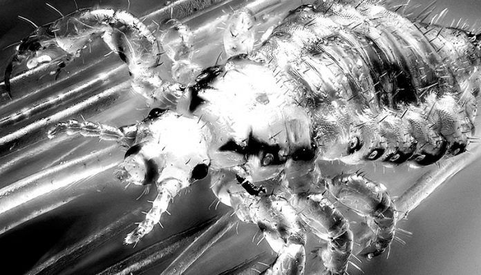 male human head louse