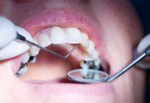 La UE prohíbe el mercurio dental en niños y mujeres embarazadas o en periodo de lactancia empastemercurio