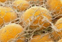 Disruptores endocrinos, otra explicación a la epidemia mundial de obesidad Disruptores endocrinos obesidad