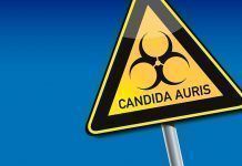 Cómo prevenir la candidiasis de forma natural Cómo prevenir la candidiasis de forma natural Com prevenir la candidiasi de forma natural