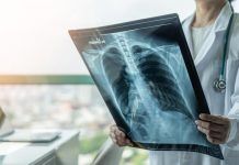 Pròpolis, bronquitis i defenses Pulmones