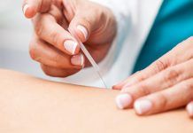 La acutomomedicina, una de las medicinas del futuro acutomomedicina