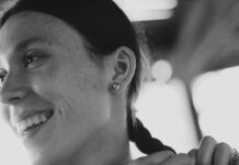 Otoplastia y autoestima: ¿Por qué cada vez más mujeres eligen esta cirugía? otoplastia