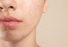 Árnica montana: belleza y salud natural Àrnica montana