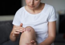 Descubre el secreto natural para reparar la piel: Helichrysum italicum Helichrysum italicum para los hematomas
