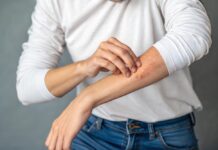 Per què una dieta bio ajuda en les al·lèrgies de pell? alergias de piel