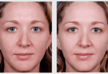 Com es fa una crema il·luminadora per a la pell apagada crema-iluminadora