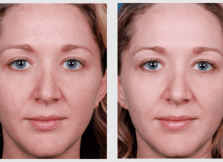 Com es fa una crema il·luminadora per a la pell apagada crema-iluminadora